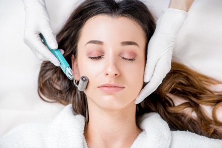 effectuer un Microneedling